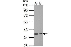 WB Image IKB alpha antibody detects IKB alpha protein by Western blot analysis. (NFKBIA Antikörper  (Center))