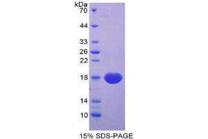 SDS-PAGE (SDS) image for Syndecan 4 (SDC4) (AA 18-145) protein (His tag) (ABIN1981028)