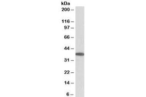 Western blot testing of human duodenum lysate with MOGAT2 antibody at 0. (MOGAT2 Antikörper)
