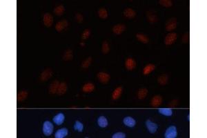 Immunofluorescence analysis of U-2 OS cells using SUMO1 Polyclonal Antibody at dilution of 1:100. (SUMO1 Antikörper)