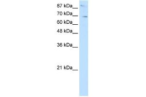 WB Suggested Anti-SKIL Antibody Titration:  2. (SKIL Antikörper  (N-Term))