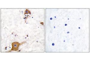 Immunohistochemistry (IHC) image for anti-Neuregulin 1 (NRG1) (Isoform 10), (N-Term) antibody (ABIN1848607) (Neuregulin 1 Antikörper  (Isoform 10, N-Term))