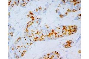 Immunohistochemistry (Paraffin-embedded Sections) (IHC (p)) image for anti-Integrin alpha 4 (ITGA4) (C-Term) antibody (ABIN1106426)