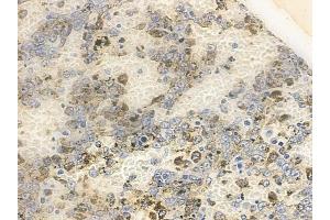 anti-Cyclin-Dependent Kinase 2 Associated Protein 2 (CDK2AP2) (C-Term) antibody
