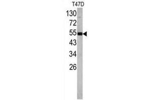 Image no. 1 for anti-Eukaryotic Translation Elongation Factor 1 alpha 1 (EEF1A1) (N-Term) antibody (ABIN452936) (eEF1A1 Antikörper  (N-Term))