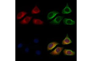 ABIN6258512 and ABIN6274729 staining Hela cells by IF/ICC.