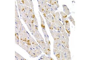 Immunohistochemistry of paraffin-embedded mouse heart using DSP antibody (ABIN6291454) at dilution of 1:100 (40x lens).
