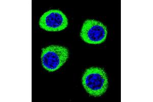 Confocal immunofluorescent analysis of CPSF3L Antibody (N-term) (ABIN655113 and ABIN2844744) with U-251MG cell followed by Alexa Fluor 488-conjugated goat anti-rabbit lgG (green).
