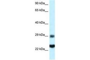 Image no. 1 for anti-Ribosomal Protein S9 (RPS9) (C-Term) antibody (ABIN6747457) (RPS9 Antikörper  (C-Term))