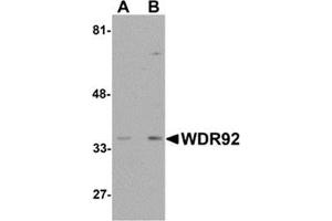 Western blot analysis of WDR92 in human kidney tissue lysate with WDR92 antibody at (A) 1 and (B) 2 μg/ml. (WDR92 Antikörper  (Center))