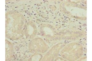 Immunohistochemistry of paraffin-embedded human kidney tissue using ABIN7163868 at dilution of 1:100 (GALNT14 Antikörper  (AA 35-335))