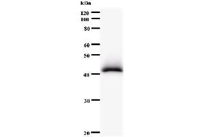 Western Blotting (WB) image for anti-PDS5, Regulator of Cohesion Maintenance, Homolog B (PDS5B) antibody (ABIN931004) (PDS5B Antikörper)