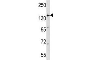 APC antibody western blot analysis in mouse heart tissue lysate (APC Antikörper  (AA 1148-1176))