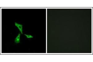 Immunofluorescence analysis of HeLa cells, using GPR101 Antibody. (GPR101 Antikörper  (C-Term))