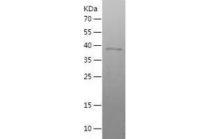 Western Blotting (WB) image for Transcription Factor MafF (MAFF) (AA 1-164) protein (His-IF2DI Tag) (ABIN7125449) (MafF Protein (AA 1-164) (His-IF2DI Tag))