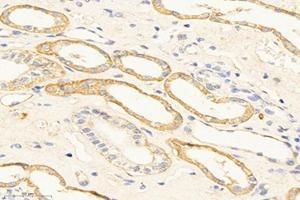 Immunohistochemistry analysis of paraffin-embedded mouse kidney using,TMEM213 (ABIN7075999) at dilution of 1: 2000