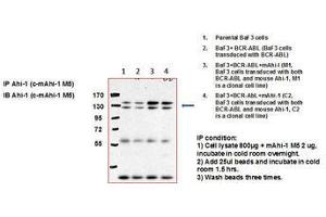 Image no. 1 for anti-Abelson Helper Integration Site 1 (AHI1) (C-Term) antibody (ABIN790758)