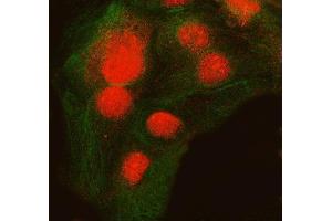 IF analysis of SNRNP200 and Tubulin beta using anti-SNRNP200 antibody (ABIN7602032) and anti-Tubulin beta antibody (ABIN7602744). (SNRNP200 Antikörper  (AA 557-2129))
