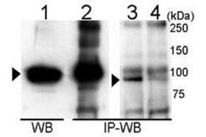 Immunoprecipitation and Western blot analysis of anti-UVRAG Antibody  in 293T cells. (UVRAG Antikörper  (C-Term))