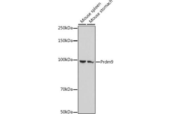 PRDM9 Antikörper