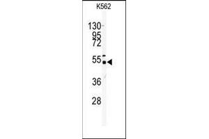 Western blot analysis of anti-GALK2 Antibody (N-term) in K562 cell line lysates (35ug/lane). (GALK2 Antikörper  (N-Term))