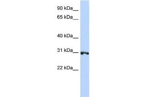 WB Suggested Anti-RNF126 Antibody Titration:  0. (RNF126 Antikörper  (N-Term))