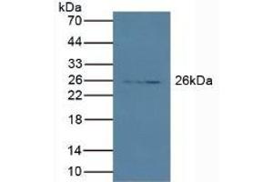 Detection of PRSS2 in Porcine Pancreas lysate using Polyclonal Antibody to Protease, Serine 2 (PRSS2)