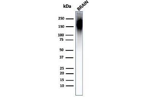 Western Blot Analysis of Human Brain Tissue Lysate using Neurofilament Mouse Monoclonal Antibody (NF421). (NEFH Antikörper)