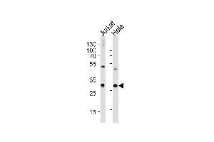 Western blot analysis of lysates from Jurkat, HeLa cell line (from left to right), using CZB Antibody (N-term) 2888a. (CAPZB Antikörper  (N-Term))