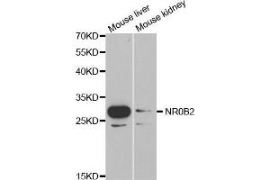 Western blot analysis of extracts of various cell lines, using NR0B2 antibody. (NR0B2 Antikörper  (AA 1-257))