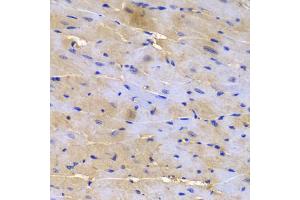 Immunohistochemistry of paraffin-embedded mouse heart using SGCE antibody (ABIN5973070) at dilution of 1/200 (40x lens). (SGCE Antikörper)