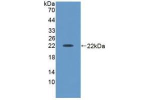 Western blot analysis of recombinant Human ACVA. (ACVA Antikörper  (AA 44-178))