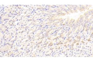 Detection of LIPC in Mouse Stomach Tissue using Polyclonal Antibody to Lipase, Hepatic (LIPC) (LIPC Antikörper  (AA 159-415))