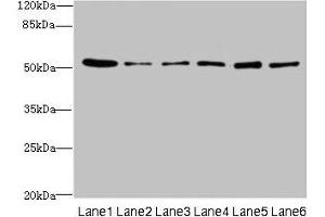 Western blot All lanes: ZNF398 antibody at 3 μg/mL Lane 1: 293T whole cell lysate Lane 2: Hela whole cell lysate Lane 3: HepG2 whole cell lysate Lane 4: Jurkat whole cell lysate Lane 5: Caco-2 whole cell lysate Lane 6: A549 whole cell lysate Secondary Goat polyclonal to rabbit IgG at 1/10000 dilution Predicted band size: 72, 53 kDa Observed band size: 53 kDa (ZNF398 Antikörper  (AA 401-642))