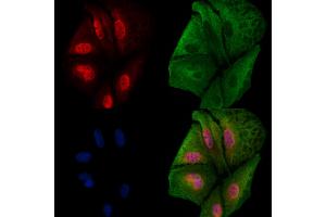 ABIN6260386 and ABIN6279208 staining  cells by IF/ICC.
