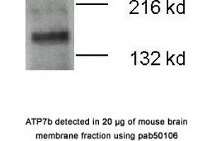 Image no. 1 for anti-ATPase, Cu++ Transporting, beta Polypeptide (ATP7B) (N-Term) antibody (ABIN363415) (ATP7B Antikörper  (N-Term))
