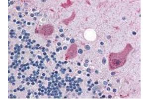 Immunohistochemistry (IHC) image for anti-Cyclin antibody (ABIN964620) (Cyclin Antikörper)