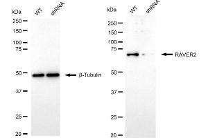 Western blotting analysis using RAVER2 antibody (ABIN7800211).