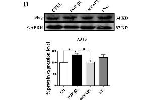 Slug is regulated by the co-transcriptional complex YAP1/TEAD in the EMT program of A549 cells. (GAPDH Antikörper)