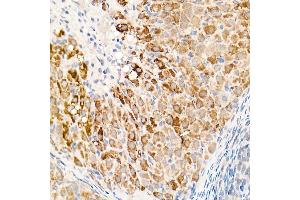 Immunohistochemistry of paraffin-embedded rat ovary using OGDH Rabbit pAb (ABIN6131414, ABIN6145003, ABIN6145005 and ABIN6222018) at dilution of 1:25 (40x lens). (alpha KGDHC Antikörper  (AA 148-427))