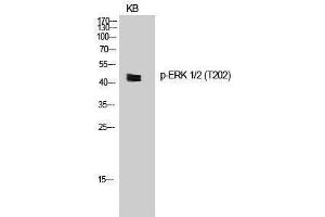 Western Blotting (WB) image for anti-Mitogen-Activated Protein Kinase 1/3 (MAPK1/3) (pThr202) antibody (ABIN3181999) (ERK1/2 Antikörper  (pThr202))