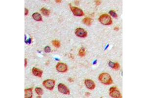 Immunohistochemical analysis of NOTCH1 staining in human brain formalin fixed paraffin embedded tissue section.