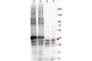 Image no. 1 for anti-Growth Differentiation Factor 15 (GDF15) (N-Term) antibody (ABIN1101713) (GDF15 Antikörper  (N-Term))