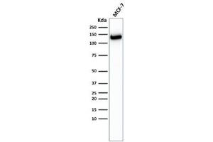 Western Blotting (WB) image for anti-Cadherin 1, Type 1, E-Cadherin (Epithelial) (CDH1) antibody (ABIN5707887)
