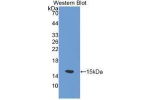 Western blot analysis of the recombinant protein. (SLC30A5 Antikörper  (AA 639-751))
