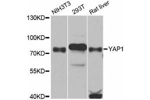 Western blot analysis of extracts of various cell lines, using YAP1 antibody (ABIN5974703) at 1/1000 dilution. (YAP1 Antikörper)