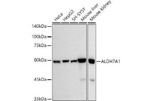 Western blot analysis of extracts of various cell lines, using  antibody (ABIN7265544) at 1:500 dilution. (ALDH7A1 Antikörper)