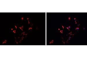 ABIN6279542 staining HEPG2 cells by IF/ICC. (IMMP2L Antikörper  (Internal Region))