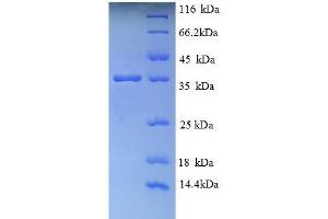 SDS-PAGE (SDS) image for Glycophorin A (GYPA) (AA 20-91), (Extracellular) protein (GST tag) (ABIN5709633) (CD235a/GYPA Protein (AA 20-91, Extracellular) (GST tag))