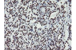 Immunohistochemical staining of paraffin-embedded Human breast tissue using anti-NONO mouse monoclonal antibody. (NONO Antikörper  (AA 184-385))